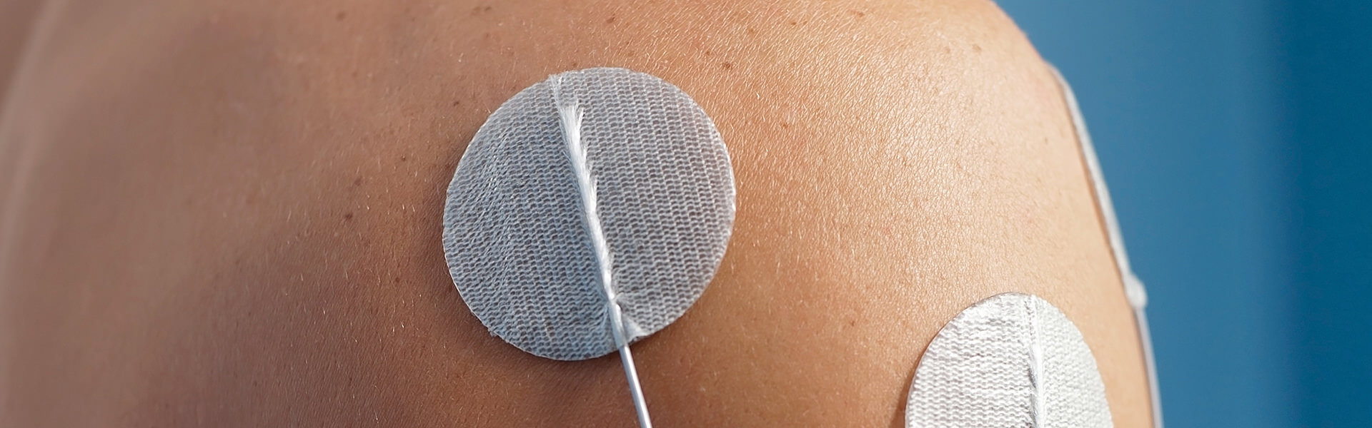 TENS Elektrotherapie